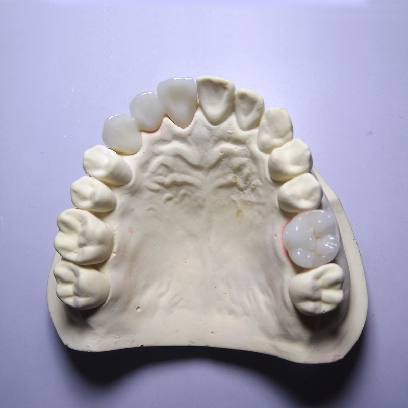 Zirconiu stratificat