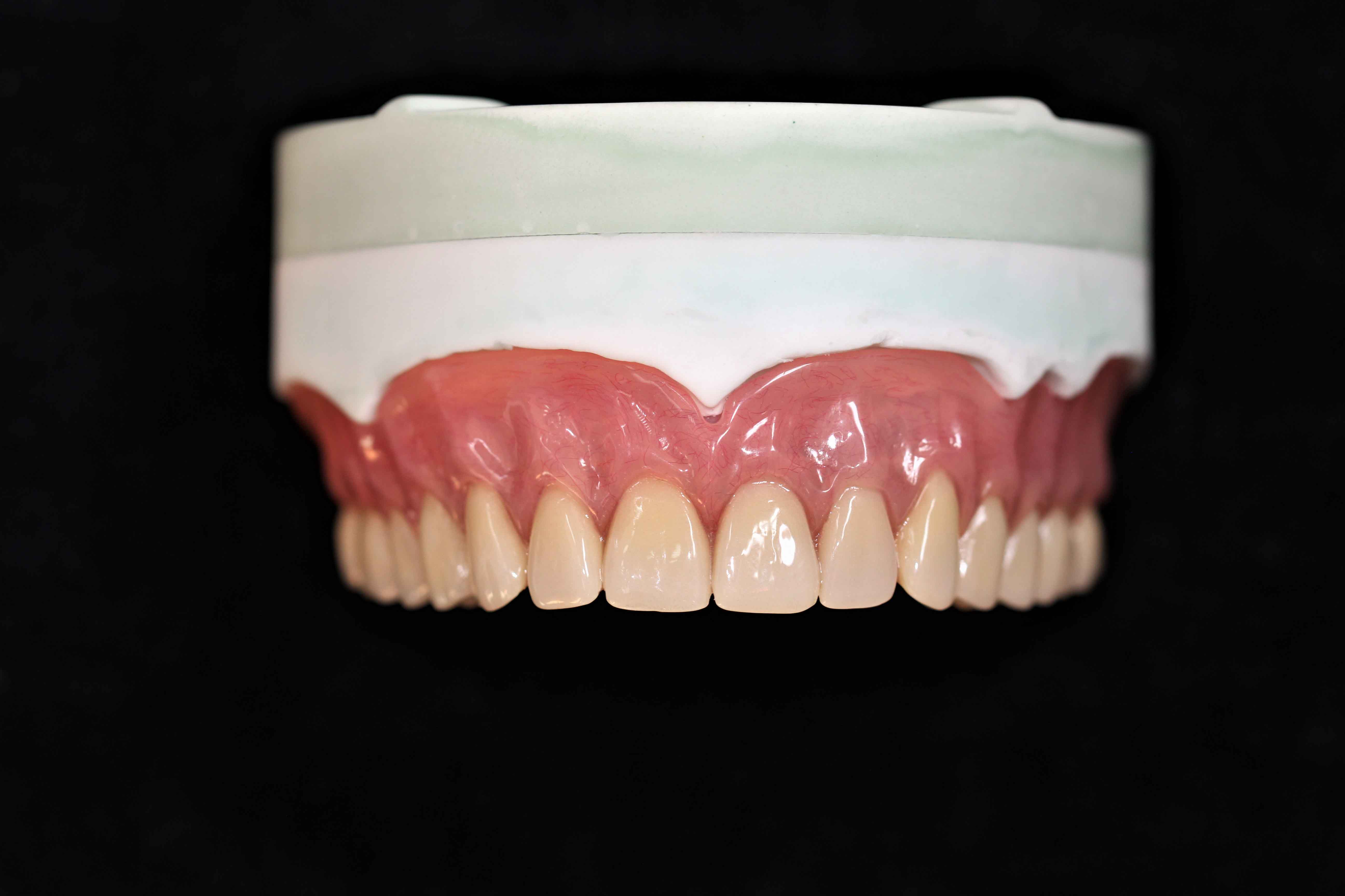 Determinarea laboratorului dentar din China a distanței verticale a protezei complete