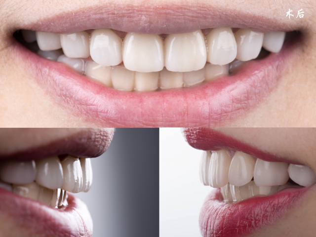 Tehnologia de fabricație a laboratorului dentar din China a podului lung din zirconiu