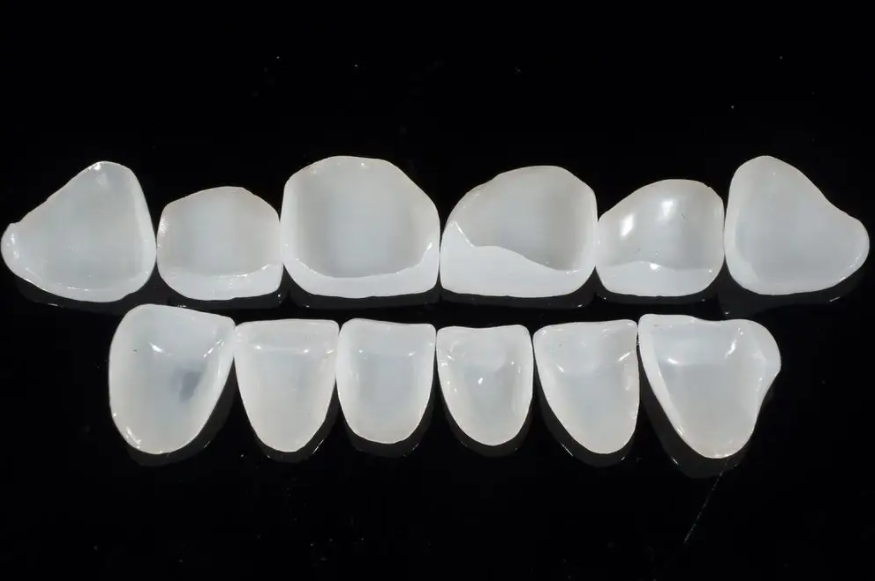 What are the advantages of dental veneers?