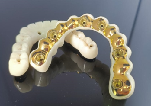 CAD/CAM Titan Implant Bar+Zirconia Bridge