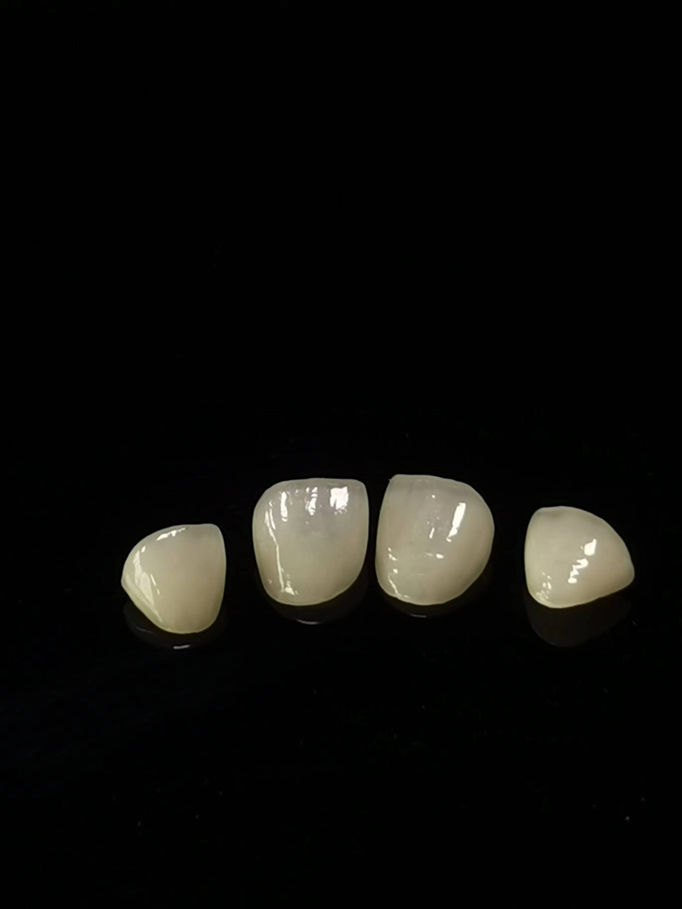 E.max Laborator stomatologic