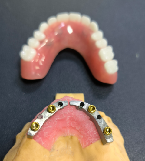Locator și Titanium Dental Bar