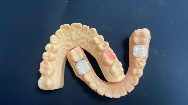 Ce este marginea umărului?