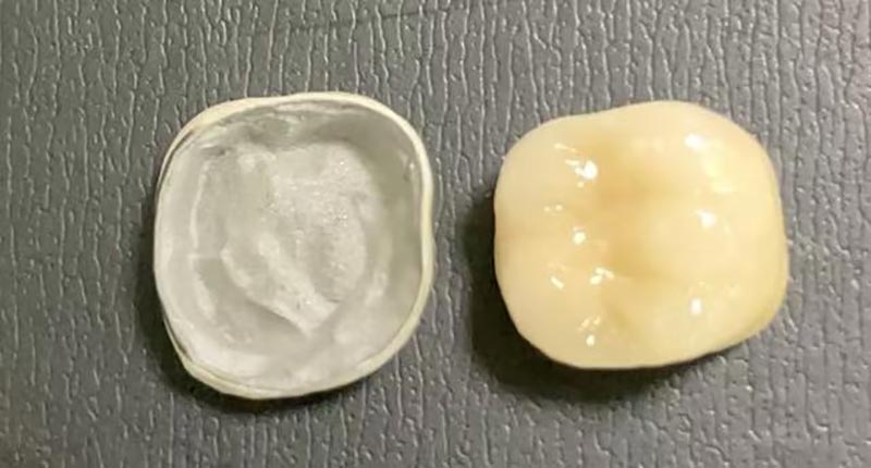 WM DENTAL LAB – Un laborator stomatologic chinez de top