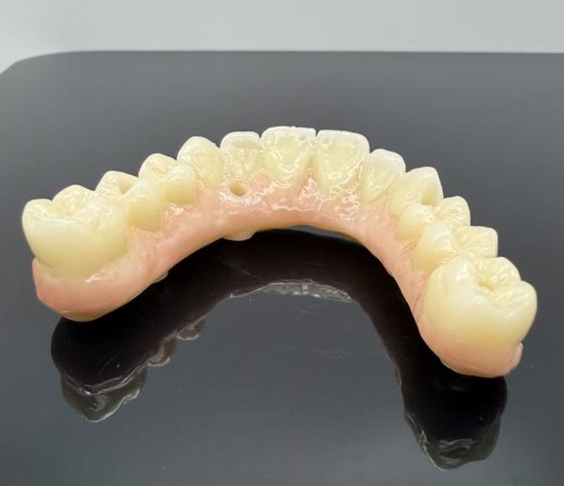 Materiale comune pentru coroane și punți dentare