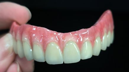 Toate pe 4 hibride - Malo Bridge Coroane de zirconiu complet peste structura titanului