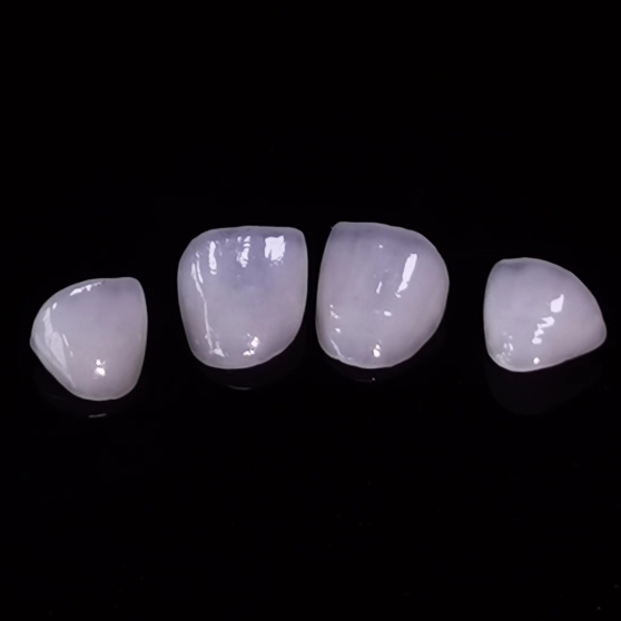 Fațete dentare translucide de înaltă Furnir Emax stratificat Lucrări de laborator dentar