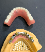 Localizator si bar stomatologic