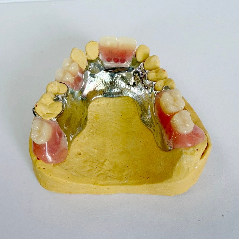 Cadru parțial de restaurare amovibil