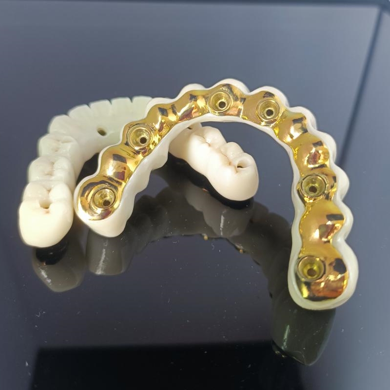 All On X Hybrid Bridge - Pod complet din zirconiu peste titan